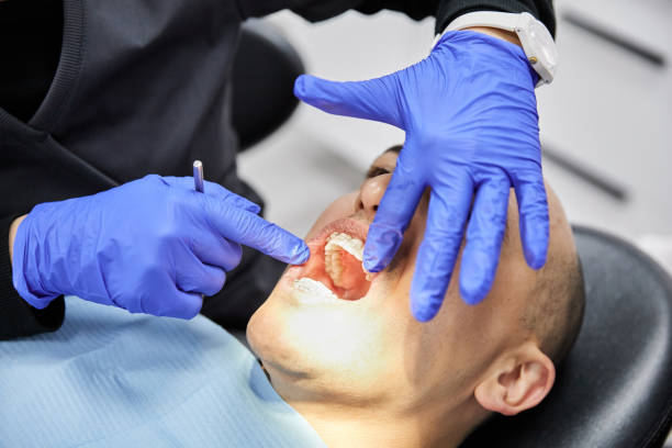 Best After-Hours Dental Trauma Care in Seacliff, CA
